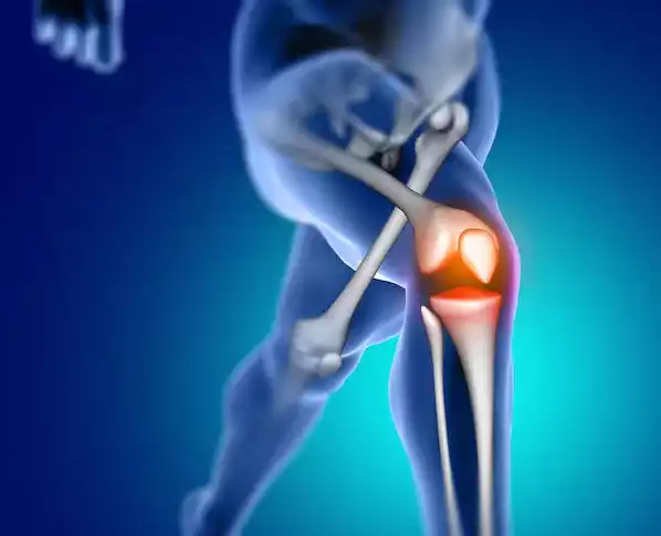 Anterior Cruciate Ligament
