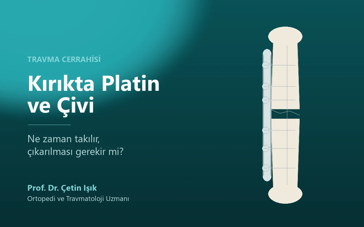 Kırıkta Platin ve Çivi: Ne Zaman Takılır, Çıkarılır mı?